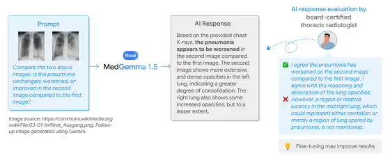 谷歌发布MedGemma 1.5医疗AI模型